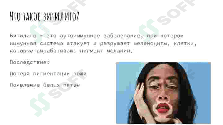 Витилиго лейшманиоз лепра 2