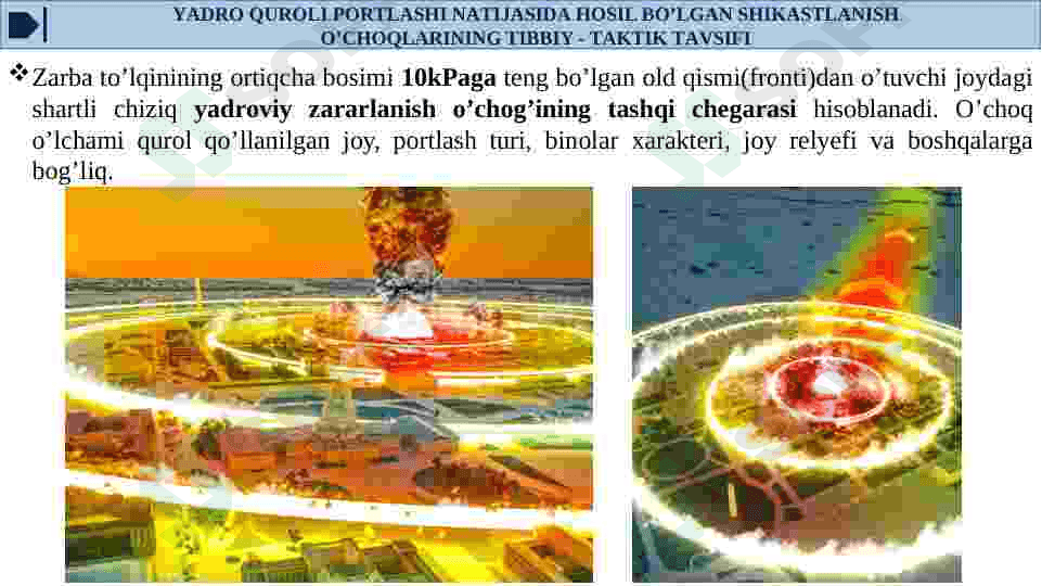 FAVQULOTDA VAZIYATLARDA VUJUDGA KELUVCHI JAROXARINING TIBBIY-TAKTIK TAVSIFI.TLANISH O’CHOQLA 4