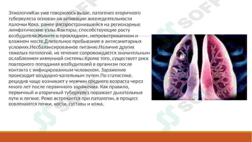 Основные методы сравнительной диагностики вторичных клинических форм туберкулеза. 4