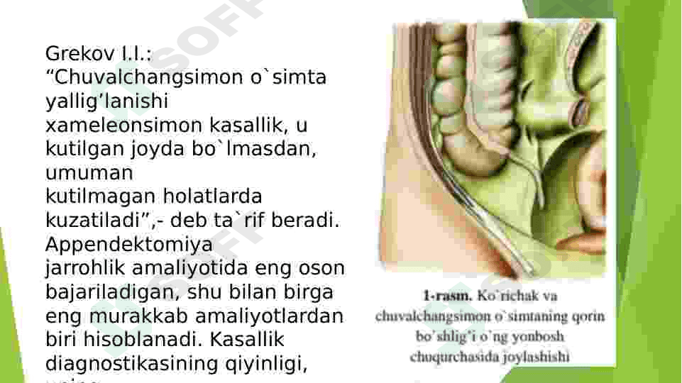 Oʻtkir apendisitni klinikasi 4