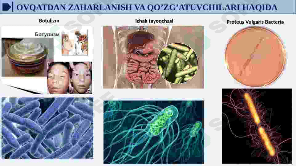 OVQATDAN ZAHARLANISH YUQUMLI KASALLIK QO’ZG’ATUVCHILARI. SALMONELLEZ VA BOTULIZM KASALLIK QO’ZG’ATUVCHILARI LABARATOR TASHXISI. 5