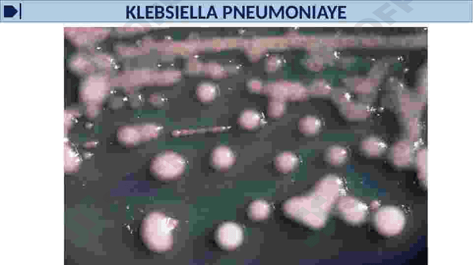 HAVO TOMCHI YUQUMLI KASALLIK QO'ZG'ATUVCHILARI, SIL, BO'G'MA, KO'K YO'TAL KASALIKLARINI LABORATORIYA TASHXISI. 5