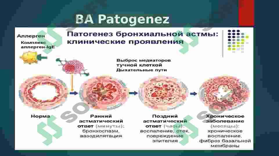 Bronxial astma , sabablari , klinikasi, davolash va praktikasi 5
