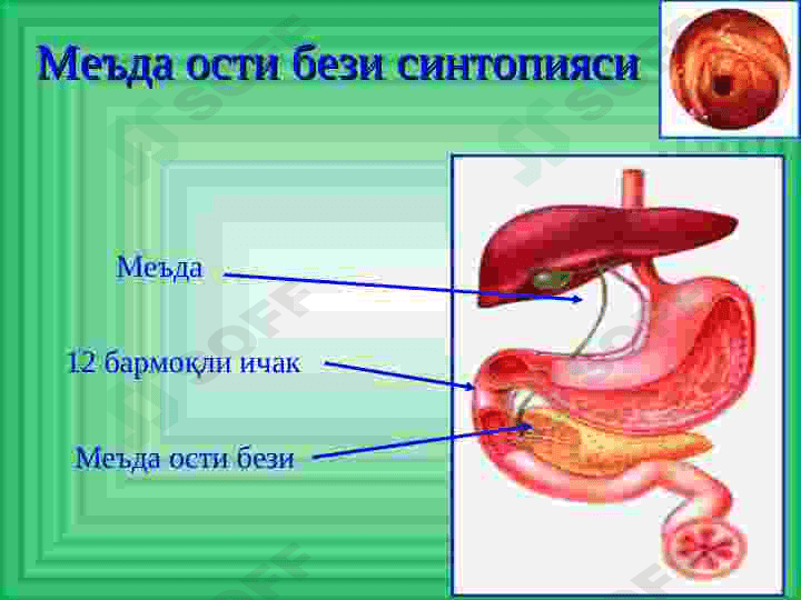 MEDA OSTI BEZI KASALLIKLARI 7
