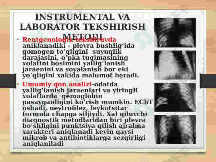 Plevritlar. Etiologiyasi, klinikasi, davolash usullari 8