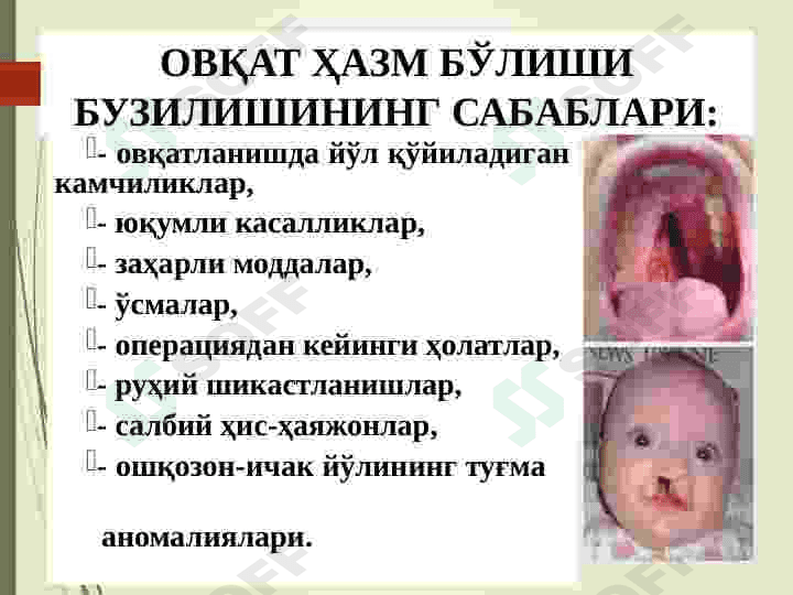 OVQAT HAZM QILISH SISTEMASINING PATOFIZIOLOGIYASI 8