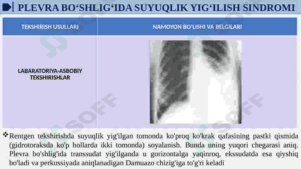 GIDROTORAKS. PNEVMOTORAKS. GEMOTORAKS 8