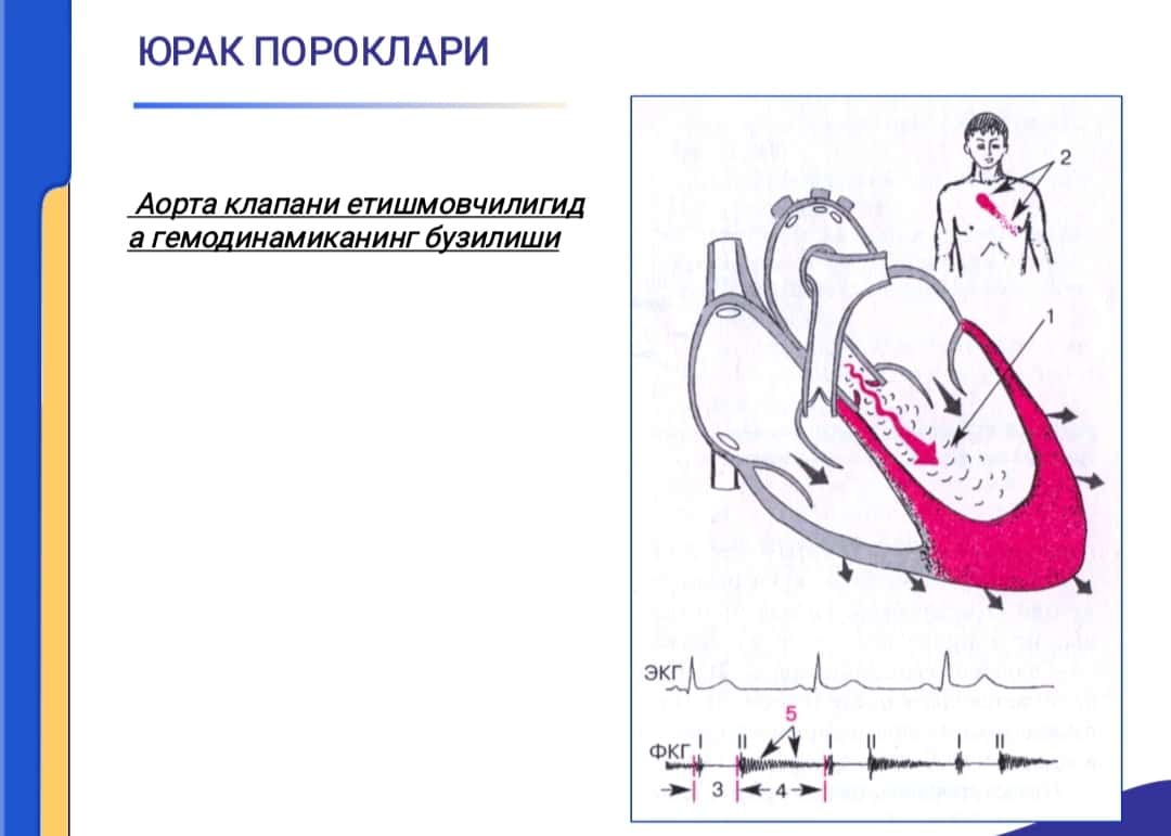 YURAK POROKLARI, AORTAL KLAPANINING YETISHMOVCHILIGI. AORTA OG`ZINING STENOZI. QON AYLANISHI YETISHMOVILIGI 1