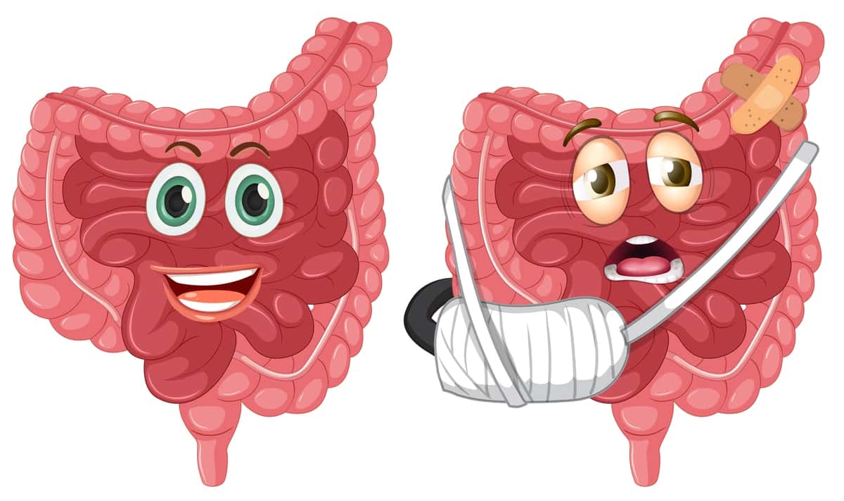 Sog'lom shikastlangan ichakni o'rnating | Set healthy injured intestine 1