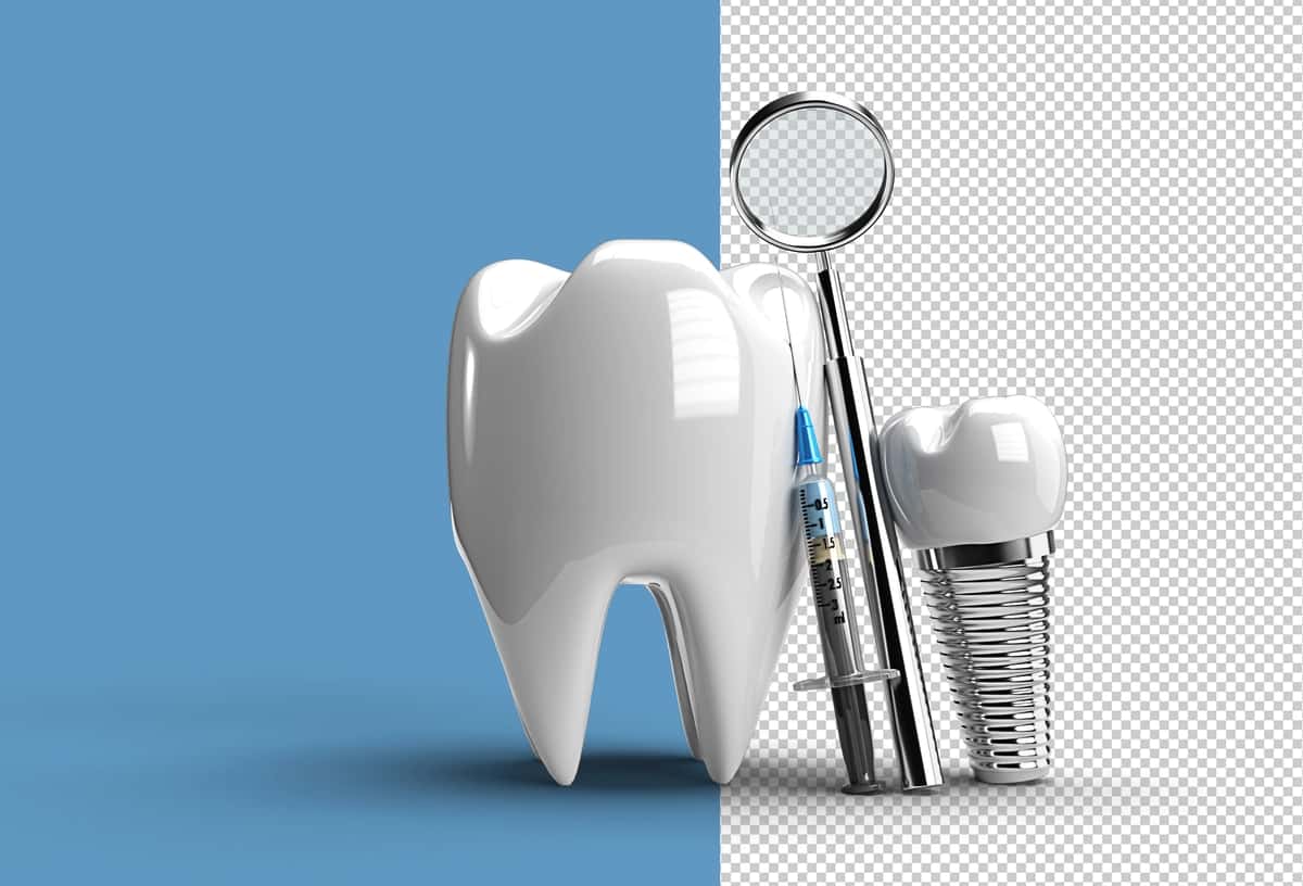 Tish implantlari jarrohlik kontseptsiyasi 3D ko'rsatuvchi shaffof PSD fayli | Dental implants surgery concept 3d rendering transparent psd file 1