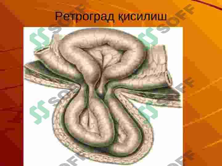 Churralar asoratlari 4