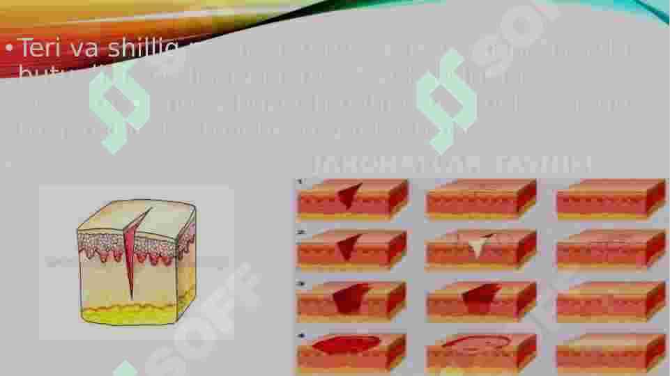 JAROHAT TURLARI 2