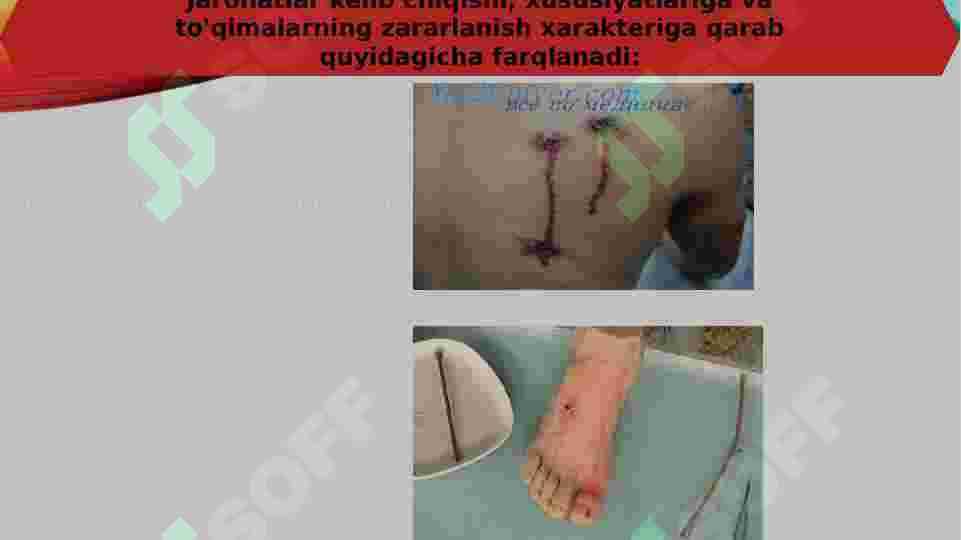 JAROHAT TURLARI 6
