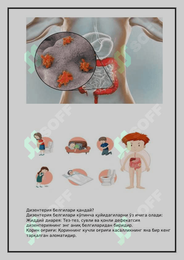 Dizenteriya kasalligi 4