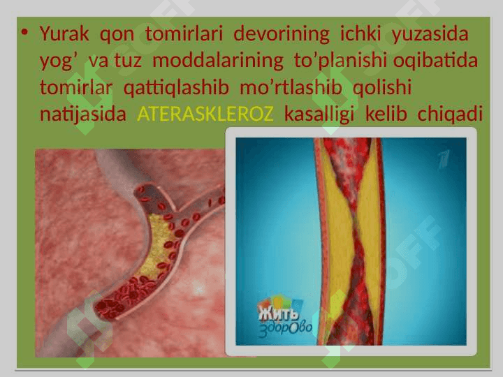 Yurak qon tomir sistemasi kasalliklari 4