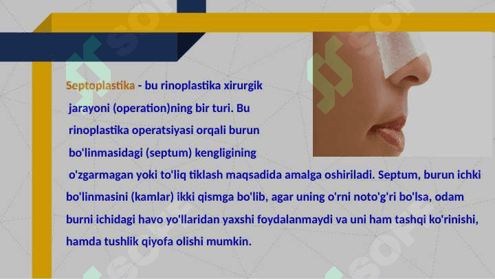 Septoplastika operatsiyasi 2