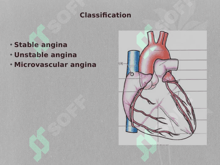 Angina pectoris 4