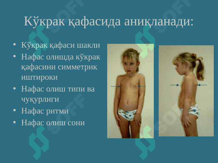 Пастки нафас йўлларини текшириш усуллари... .pptx 3