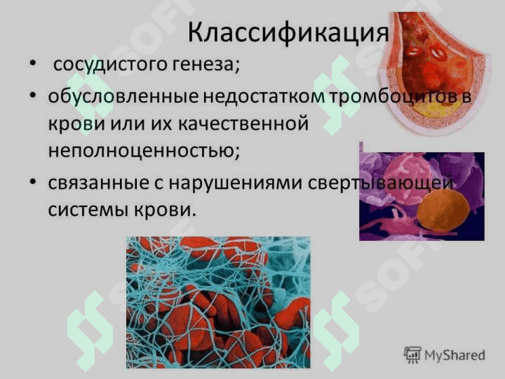 Gemorragik deatez (rus) ppt 3