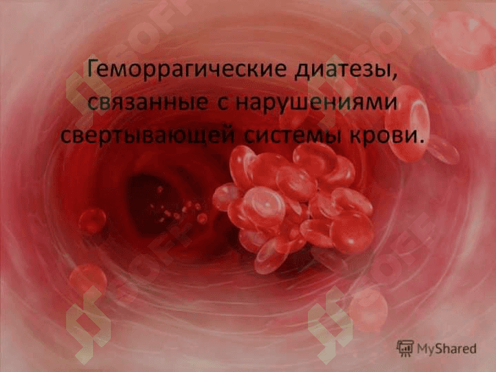 Gemorragik deatez (rus) ppt 6