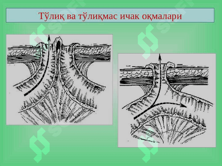 Ichak oqmalari ppt 7