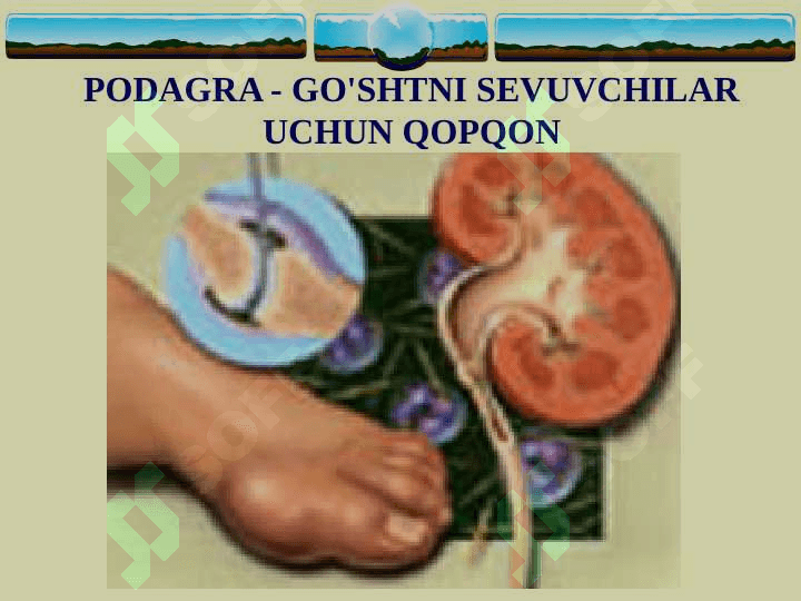 Padagra ppt 3