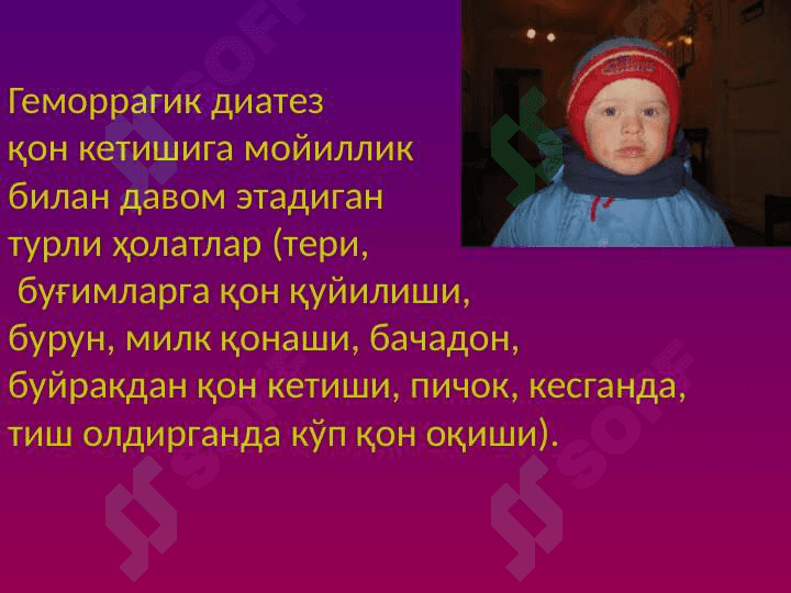 Gemorragik deatez ppt 2