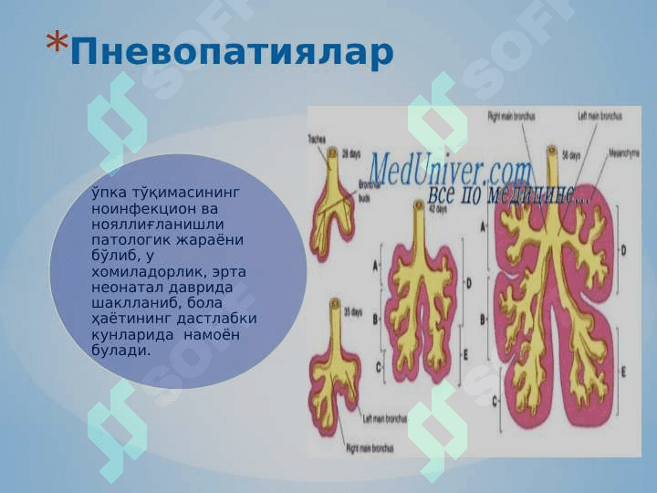 Nafas buzulish sindromi ppt 5