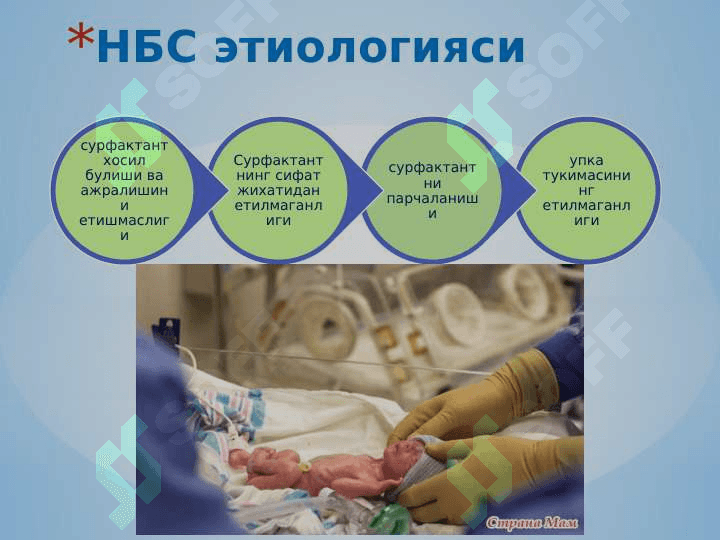 Nafas buzulish sindromi ppt 8