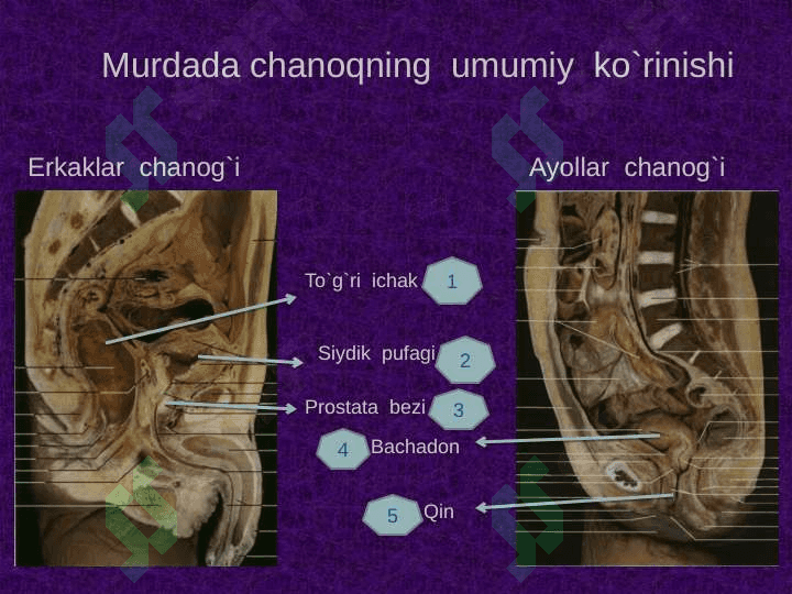 Chanoq sohasi klinik anatomiyasi . Chanoq boshlig`i azolarining topografiyasi . Chanoq azolarining operativ jarrohligi 5