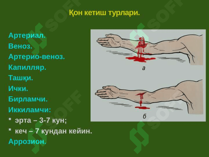 Артериал ва веноз қон томирларда бажариладиган оператив аралашувларнинг клиник анатомик негизлари. Переферик нервлардаги операциялар тамойиллари.Йирингли жараёнларнинг локализацияси ва тарқалишини клиник анатомик хусусиятлари. Ампутация ва экзартикуляциялар 7