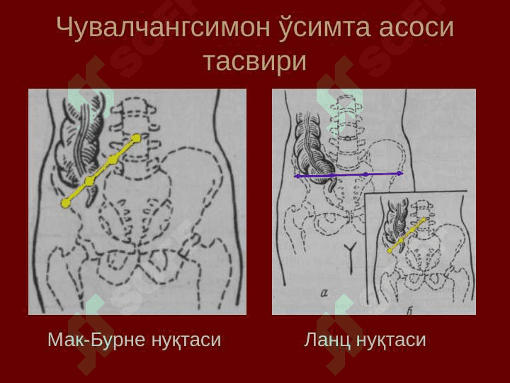 Қорин деворлари клиник анатомияси. Qorin devorlari anatomiyasi 6