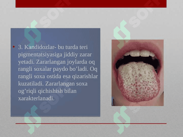 Zamburugli kasaliklarning oziga xosligi 6
