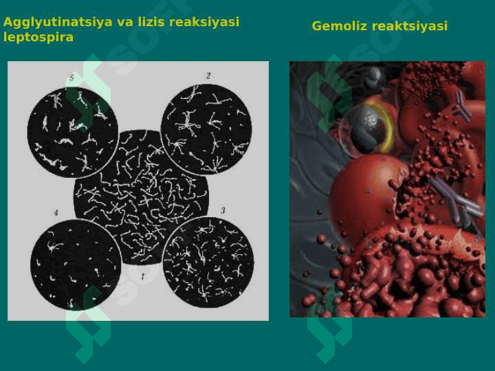 Komplement bog'lash reaksiyasi 4