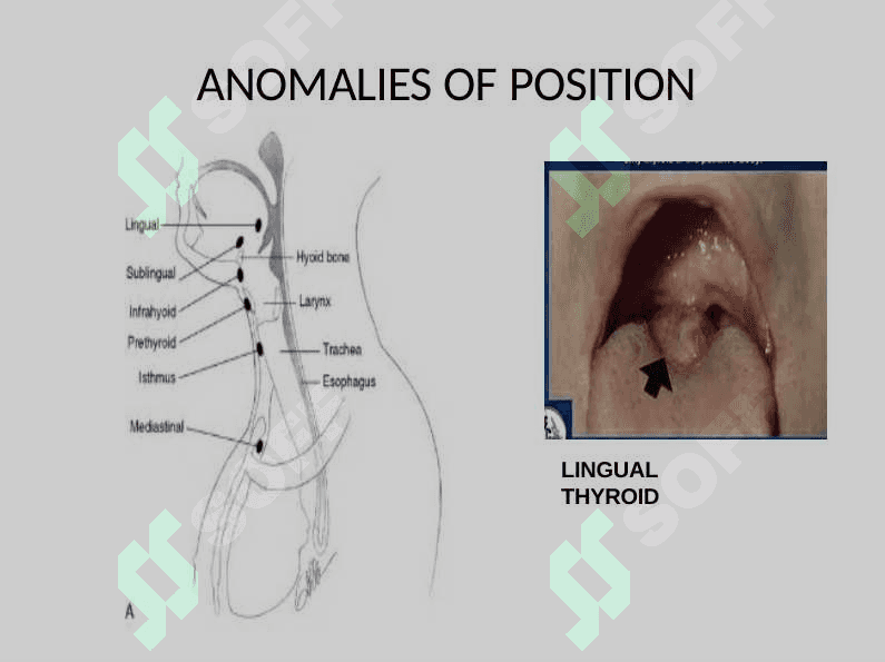 THYROID  MALIGNANCIES 7