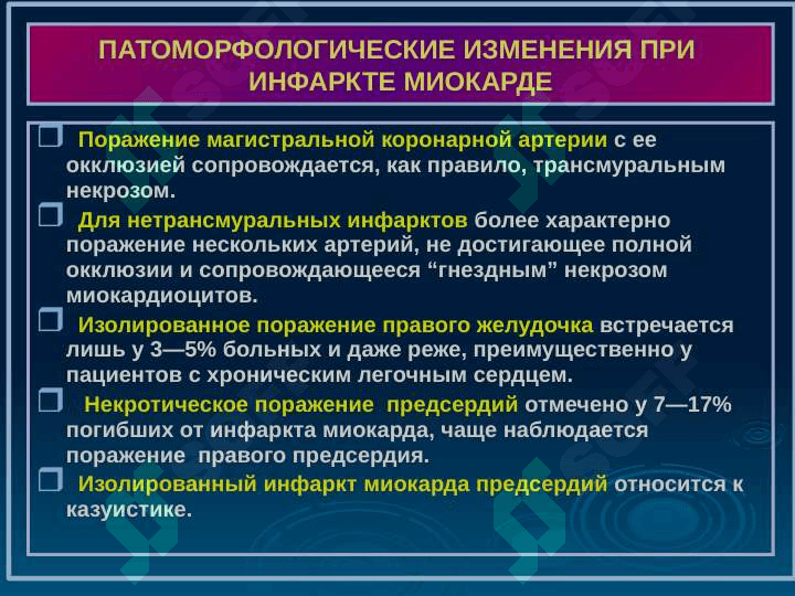 ИНФАРКТ МИОКАРДА 8