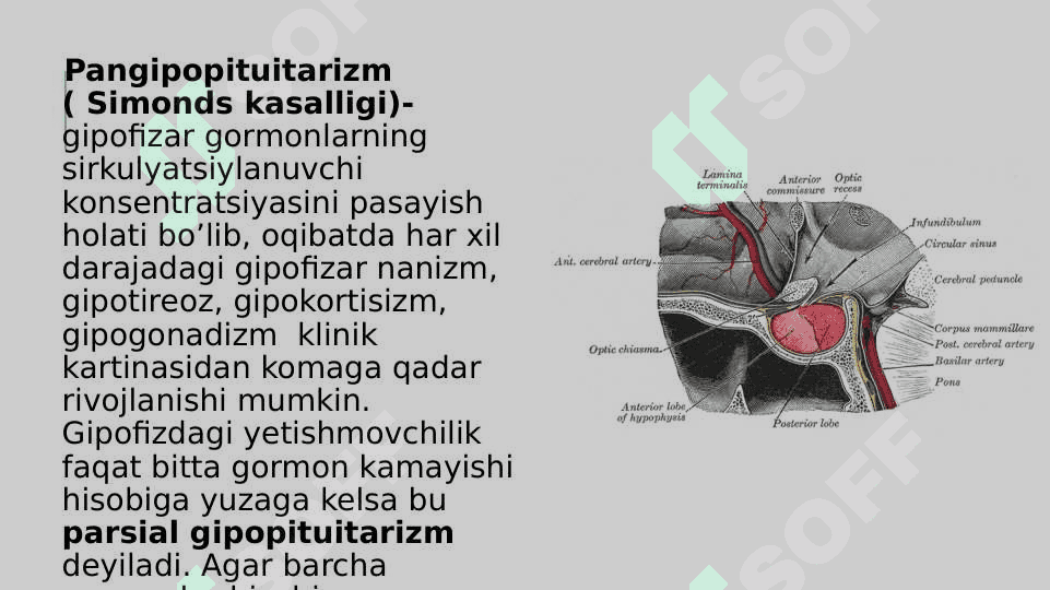 Simonds kasalligi 2