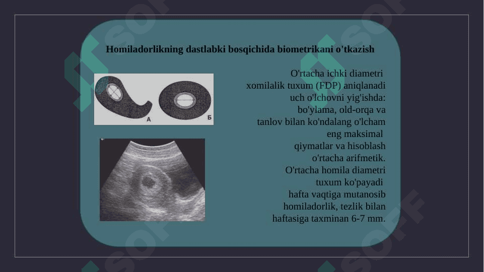Ultratovush tadqiqot homiladorlikning birinchi trimestrida 7