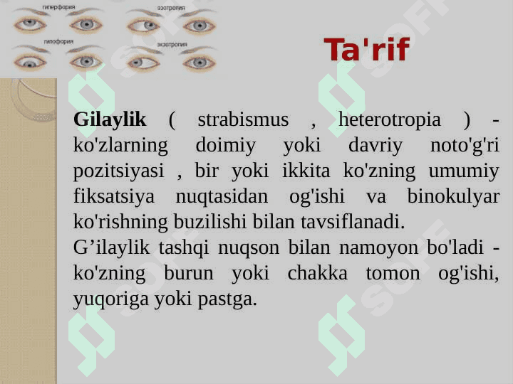 G’ilaylik(Strabizm). Diagnostika usullari 3