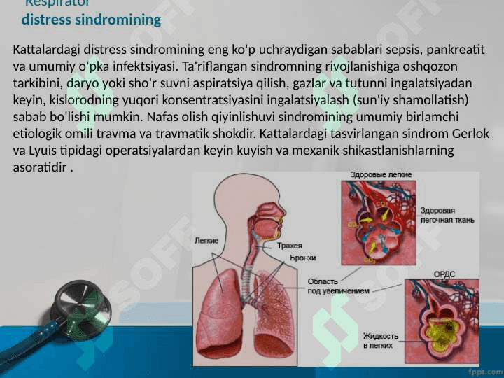 "O'tkir respirator distress sindromi" 6
