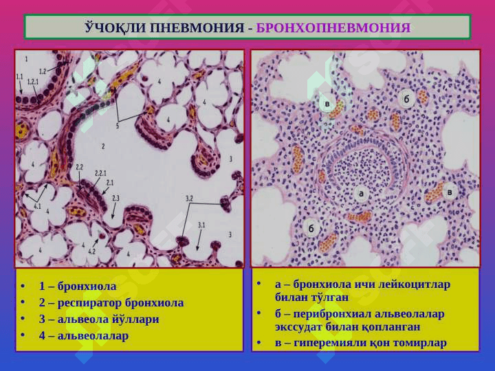 O`pka kasalliklari . Ўпка касалликлари 6