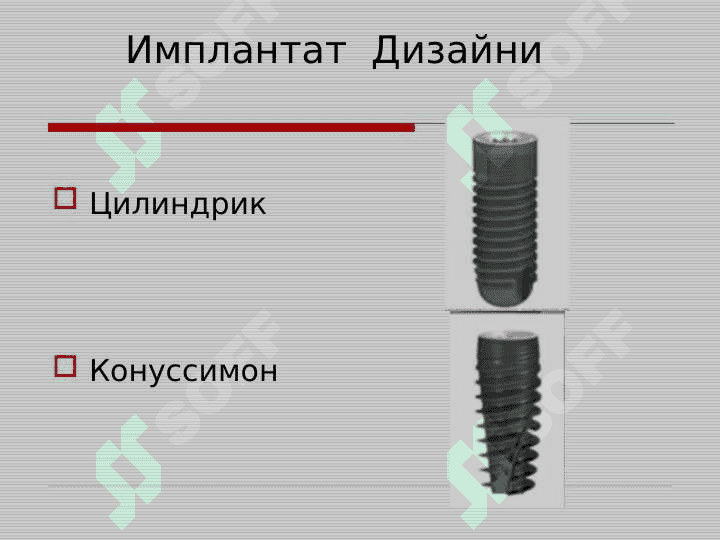 Implantlar yordamida tishlarning to'liq yo'qligini davolashning klinik protokollari. Axen tushunchasi, Abatment turlari, implantlarning analoglari. 3