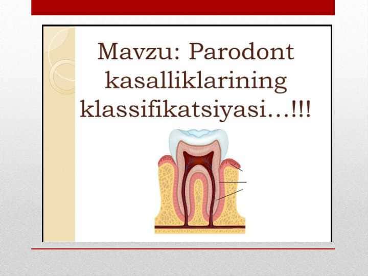 paradont kasalligining klassifikatsiyasi