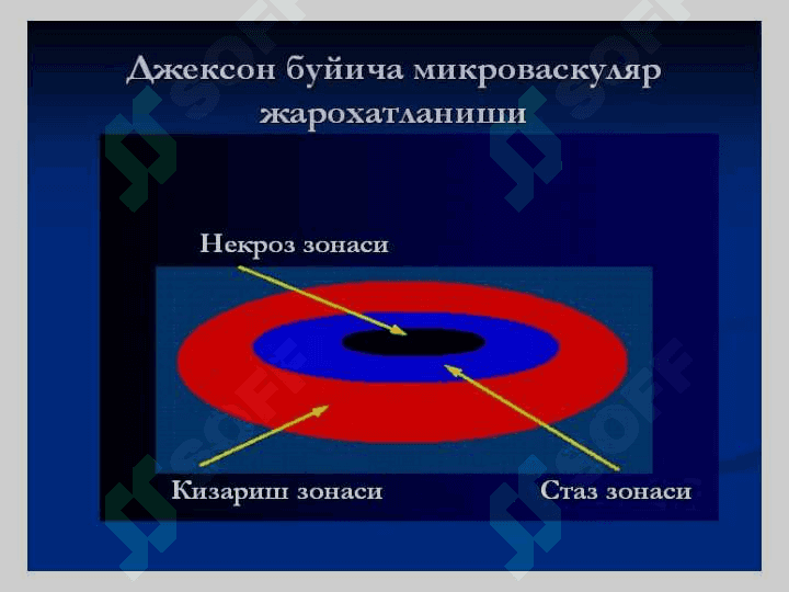Termik kuyishklar . Термик куйишлар 7