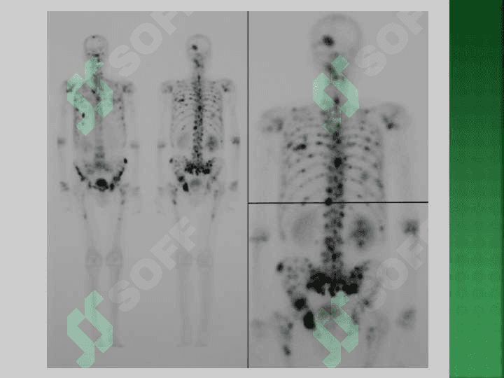 Suyak va bo`g`im tizimi kasalliklarining kompleks nur diagnostikasi . Суяк - бўғим тизими касалликларининг комплекс нур диагностикаси 8