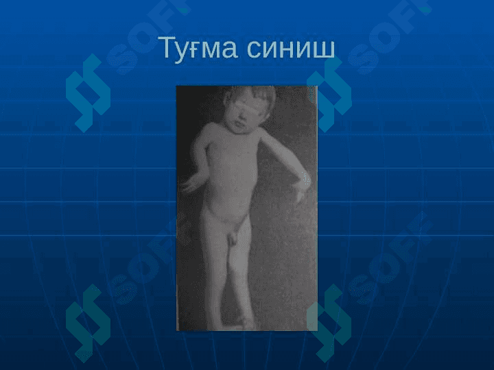 Suyaklarning sinishi va chiqishi . Суякларнинг синиши ва чикиши 4