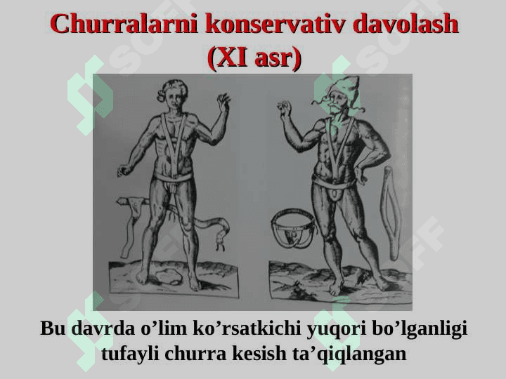 Qorin churralari 6