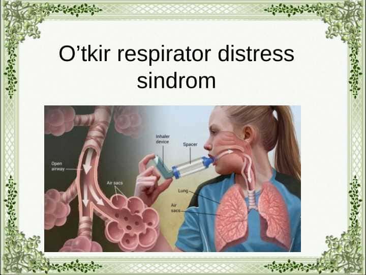O’tkir respirator distress sindrom 1