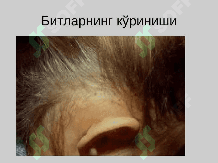Битлаш (педикулёз) 8