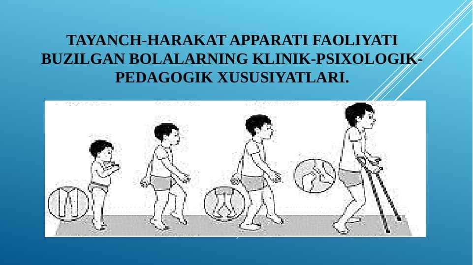 Tayanch-harakat apparati faoliyati buzilgan bolalarning klinik-psixologik-pedagogik xususiyatlari 1
